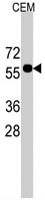 PAB3120 - CNOT4