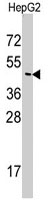 PAB3121 - Sorting nexin-6 (SNX6)