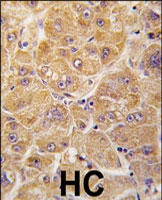 PAB3123 - ALDH1