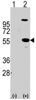 PAB3123 - ALDH1