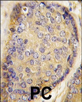 PAB3125 - Latexin