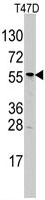 PAB3127 - ALDH6A1 / MMSDH