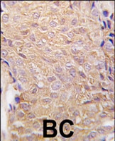 PAB3127 - ALDH6A1 / MMSDH