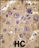PAB3128 - ALDH6A1 / MMSDH