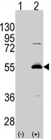 PAB3128 - ALDH6A1 / MMSDH