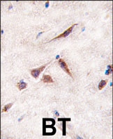 PAB3129 - ERAS / HRAS2
