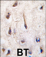 PAB3130 - ERAS / HRAS2