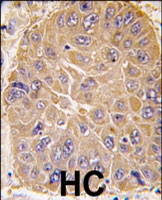 PAB3134 - ALDH5A1 / SSADH