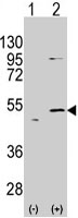 PAB3134 - ALDH5A1 / SSADH