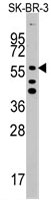 PAB3135 - ALDH5A1 / SSADH