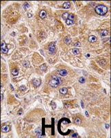 PAB3135 - ALDH5A1 / SSADH