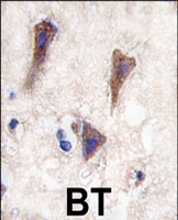 PAB3136 - Cadherin-12