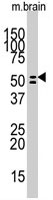 PAB3138 - Alkaline phosphatase / ALPL