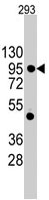 PAB3139 - CD324 / Cadherin-1
