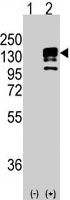 PAB3139 - CD324 / Cadherin-1