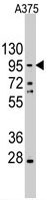 PAB3140 - CD324 / Cadherin-1