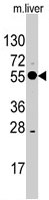 PAB3143 - ALDH8A1 / ALDH12