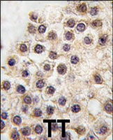 PAB3144 - ARID3B