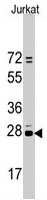 PAB3146 - CD9