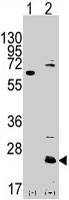 PAB3146 - CD9