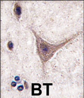 PAB3147 - Cadherin-10