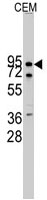 PAB3148 - Cadherin-10