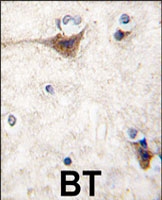 PAB3148 - Cadherin-10