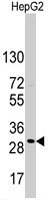 PAB3149 - CD9