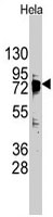 PAB3151 - DDX3X