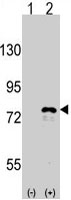 PAB3151 - DDX3X