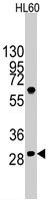 PAB3152 - LIN28B