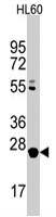 PAB3153 - LIN28B