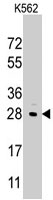 PAB3154 - LIN28B