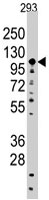 PAB3156 - Sal-like protein 4 (SALL4)