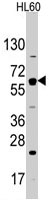 PAB3157 - GLUT2 / SLC2A2