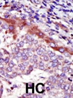 PAB3167 - HUNK / MAKV