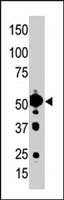 PAB3168 - STK25 / SOK1