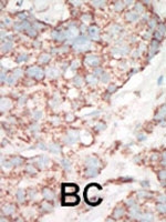 PAB3168 - STK25 / SOK1