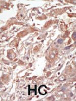 PAB3171 - STK10 / LOK