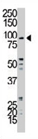 PAB3181 - MYLK