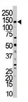 PAB3182 - MYLK