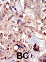 PAB3182 - MYLK