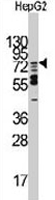 PAB3195 - MARK2