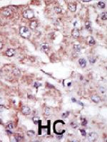 PAB3195 - MARK2