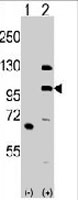 PAB3199 - MLK4