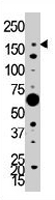 PAB3206 - PIK3C2A