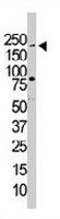 PAB3207 - PIK3C2B