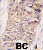 PAB3207 - PIK3C2B