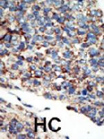 PAB3208 - PIK3C2G