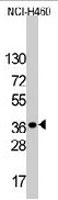 PAB3211 - LDLRAP1